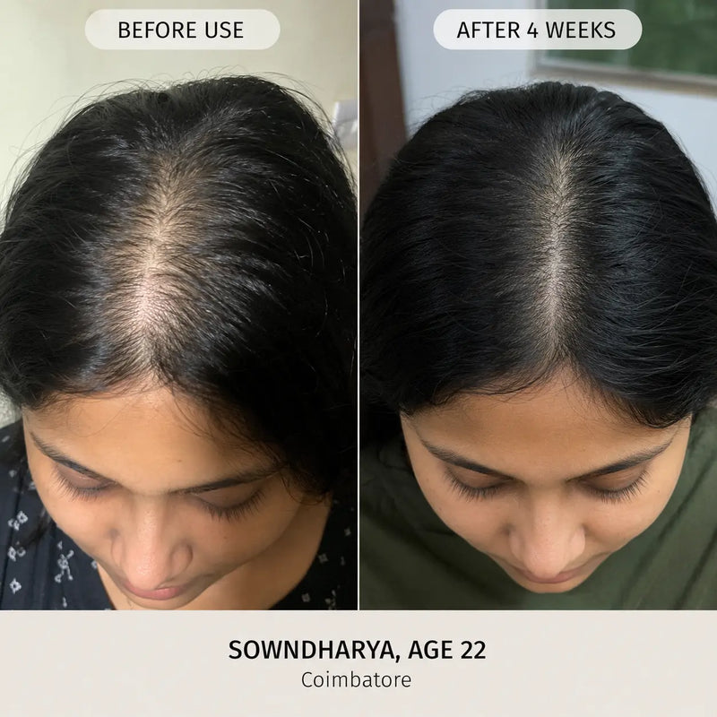 Herbal Hair Oil